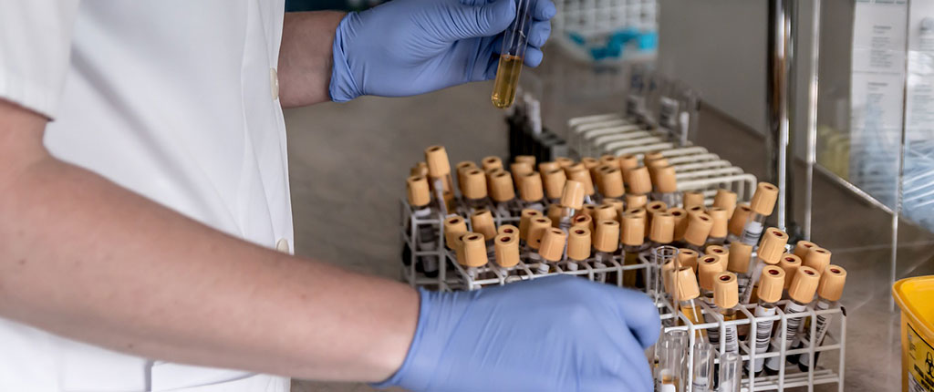 Image of a person in front of a collection of test tubes.